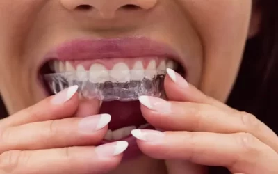 Invisalign Granada Hills: Clear Aligner Therapy for Discreet Orthodontic Correction